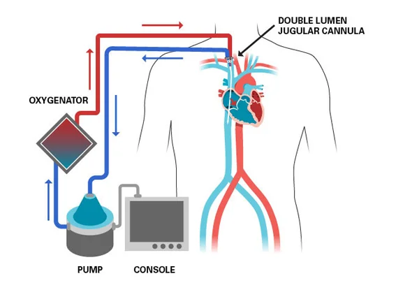 Life Support